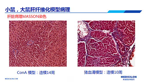 ConA和豬血清誘導的肝纖維化模型