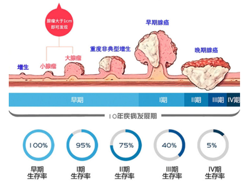 直腸癌早篩試劑盒“第一證”—足不出戶而明察秋毫